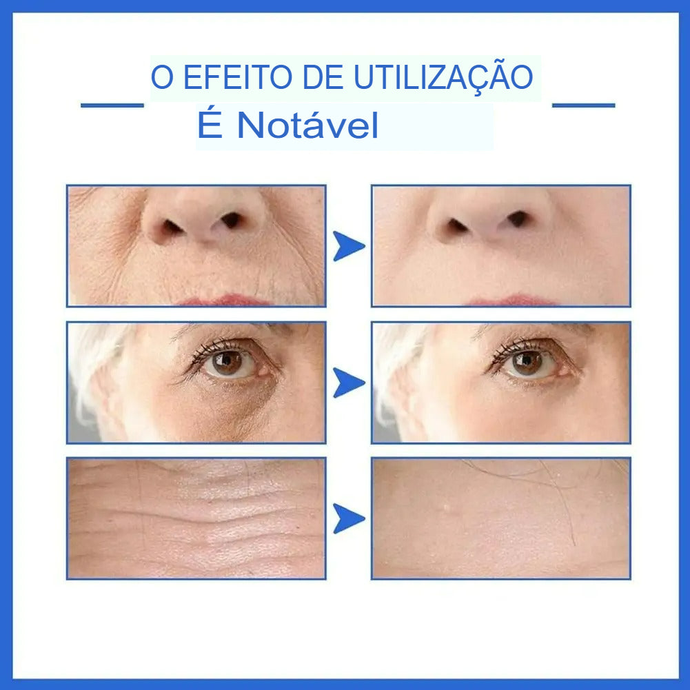 💎 Sérum Rejuvenescedor Instantâneo LIFT 15D® – Rugas, Olheiras e Manchas do Melasma! 💎