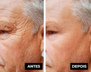 LuteinaRoll 5 em 1 ORIGINAL- Remove Olheiras, Reduz Bolsas e Revitaliza a Pele ao Redor dos Olhos