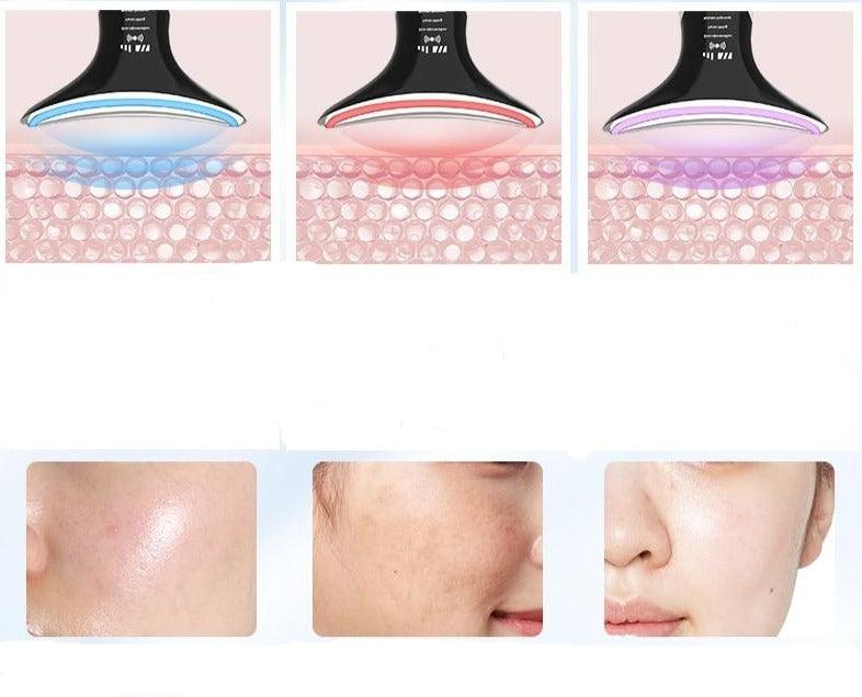 Aparelho Antirrugas Lifting Facial - Nannyvarie